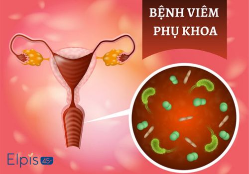 Viêm phụ khoa có quan hệ được không