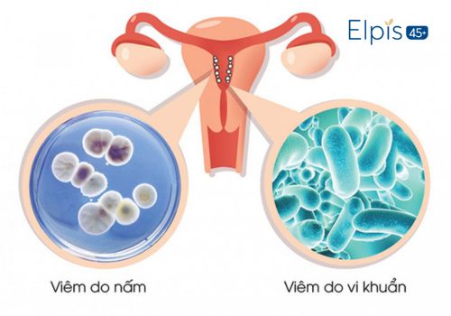 tại sao vùng kín có mùi khắm