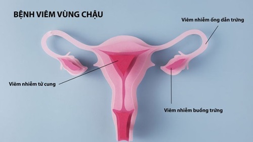 Vùng kín bị mùi hôi chua